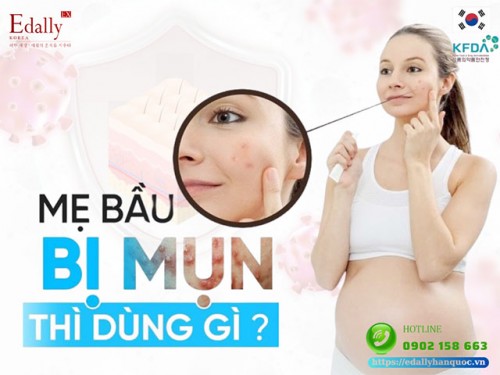 Mẹ Bầu Bị Mụn Thì Dùng Gì Để Chăm Sóc Da?