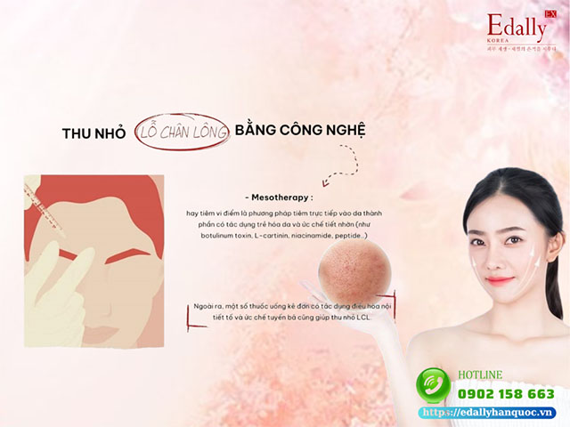 Cách thu nhỏ lỗ chân lông bằng công nghệ Mesotherapy