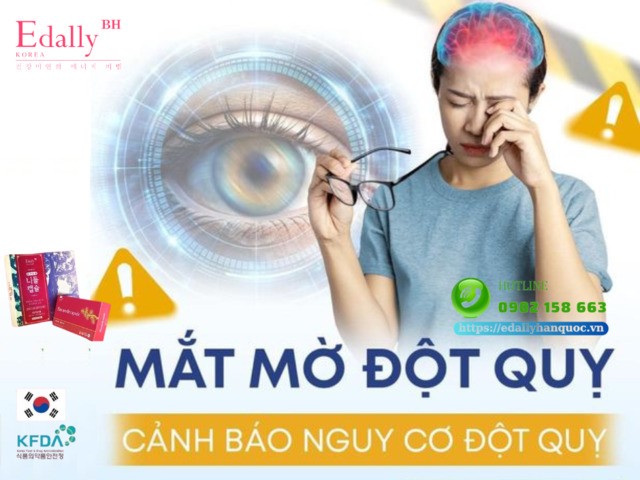 Mắt mờ đột ngột cảnh báo nguy cơ đột quỵ cận kề