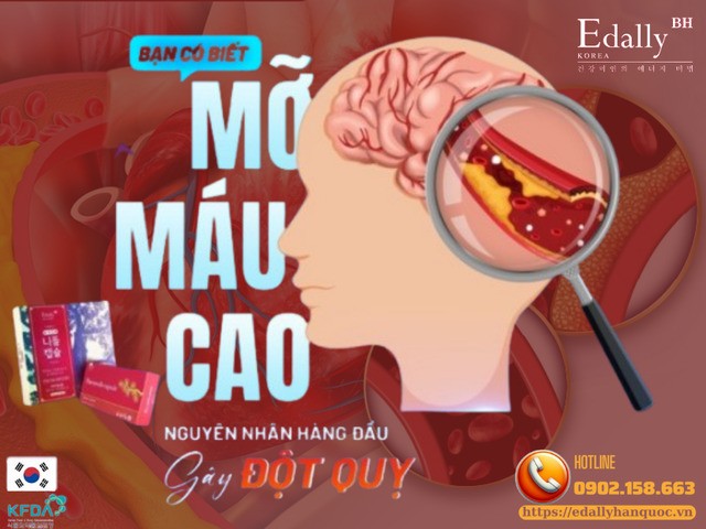 Mỡ máu cao - Kẻ giết người thầm lặng gây ra đột quỵ
