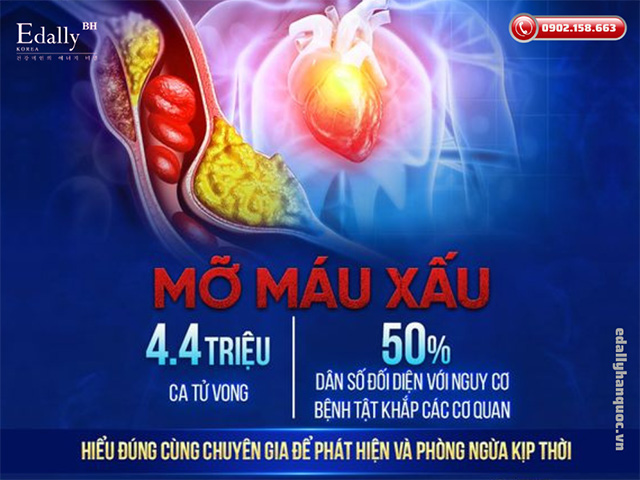 Mỡ Máu Cao & Giải Pháp Toàn Diện Cho Dòng Máu Sạch