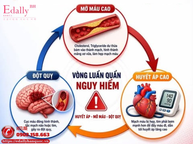 Vòng luẩn quẩn nguy hiểm: huyết áp - mỡ máu - đột quỵ