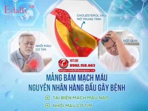 Mỡ Và Mảng Bám Thành Mạch - Làm Sao Để Loại Bỏ?