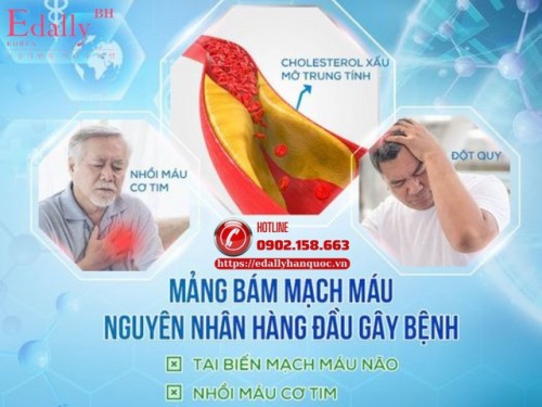 Mỡ Máu Và Mảng Xơ Vữa Mạch Máu Có Mối Liên Hệ Như Thế Nào?
