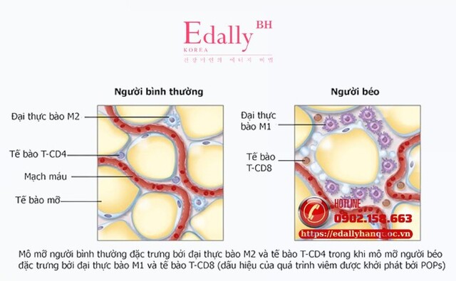 Hình ảnh minh họa mô mỡ ở người bình thường và mô mỡ ở người béo phì