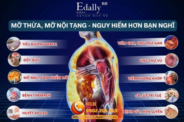 Mỡ nội tạng là tác nhân gây nhiều bệnh lý nguy hiểm cho cơ thể