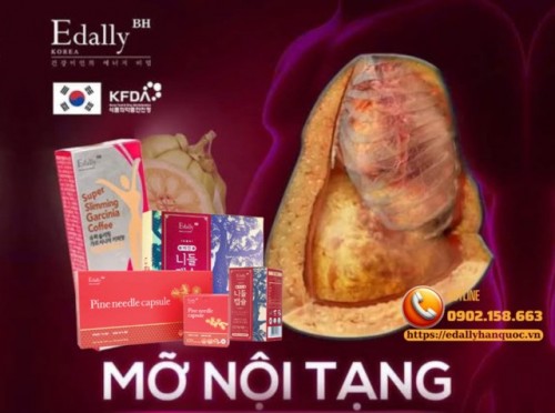 Mỡ Nội Tạng - Kẻ Giấu Mặt Phía Sau Bụng Phệ Và Cơn Đột Quỵ Bất Ngờ