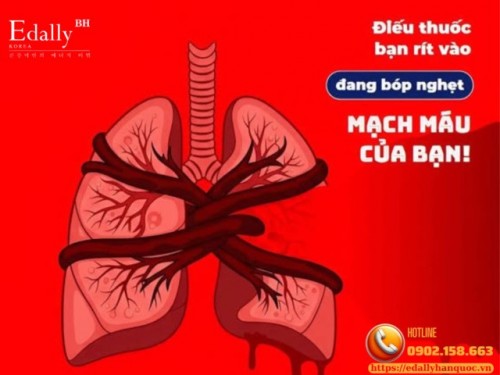 Hút Thuốc Lá - Quả Bom Nổ Chậm Của Hệ Mạch Máu