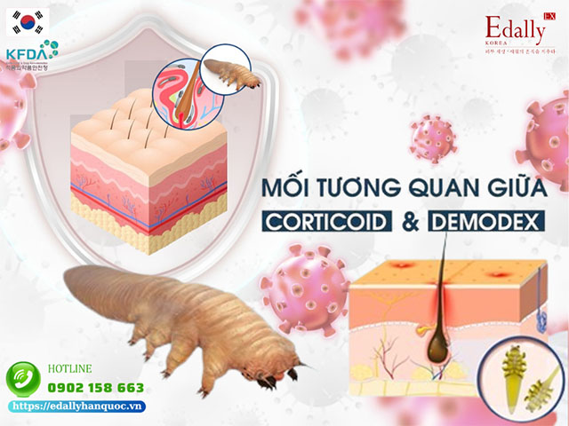 Mối tương quan giữa viêm da Demodex và Corticoid