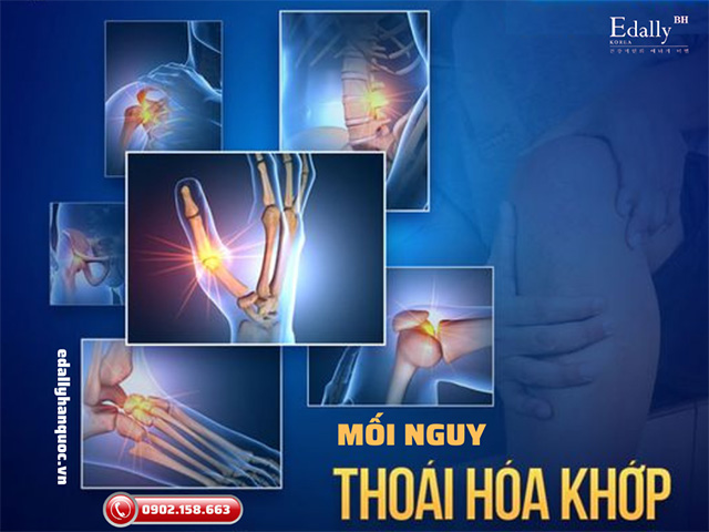 Căn bệnh thoái hóa khớp ẩn chứa nhiều mối nguy tiềm ẩn