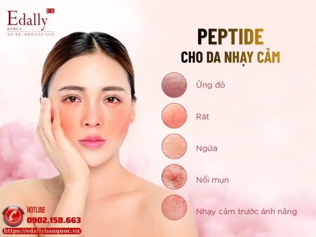 Một số peptide phù hợp cho da nhạy cảm