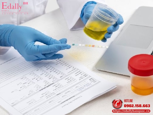 Một Số Sai Lầm Khi Nhận Định Kết Quả Xét Nghiệm Nước Tiểu