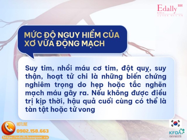 Xơ vữa động mạch nguy hiểm như thế nào?