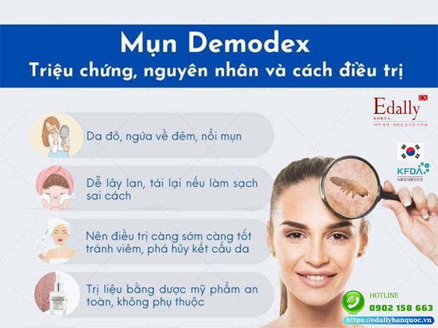 Mụn Demodex - Triệu chứng, nguyên nhân và cách điều trị dứt điểm