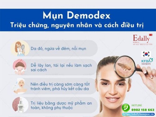 Mụn Demodex - Triệu Chứng, Nguyên Nhân Và Cách Điều Trị Dứt Điểm Tại Nhà