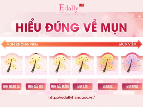 Trị Mụn - Thấu Hiểu Trước - Điều Trị Sau