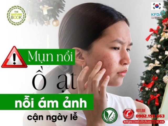 Mụn nổi ồ ạt cận ngày nghỉ lễ tết thì phải làm sao?