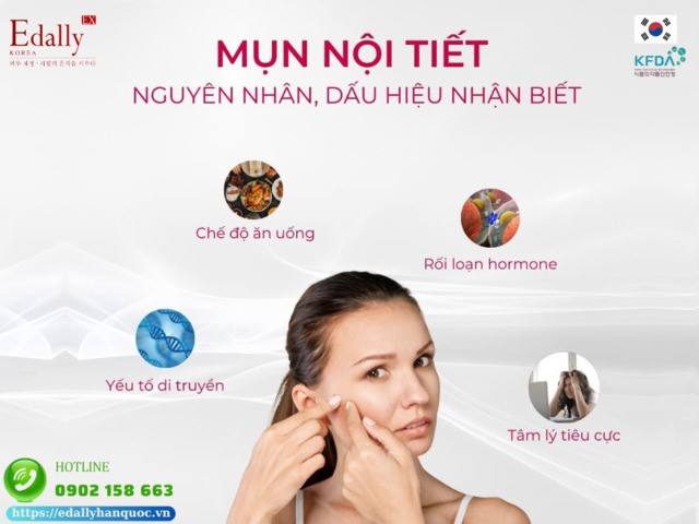Nguyên nhân và dấu hiệu nhận biết mụn ở phụ nữ trưởng thành (mụn nội tiết)