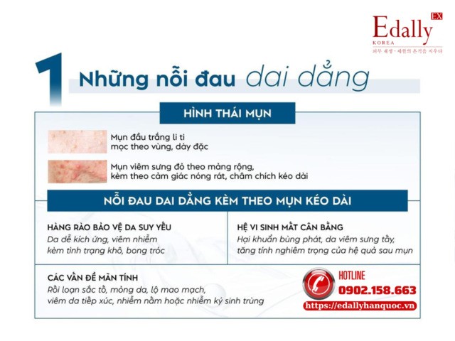Hình thái mụn trên nền da yếu và những nỗi đau dai dẳng