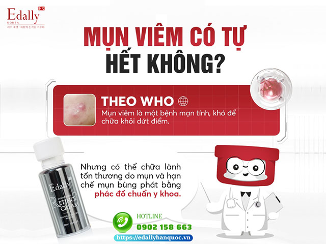 Mụn viêm lâu năm có tự hết được không?