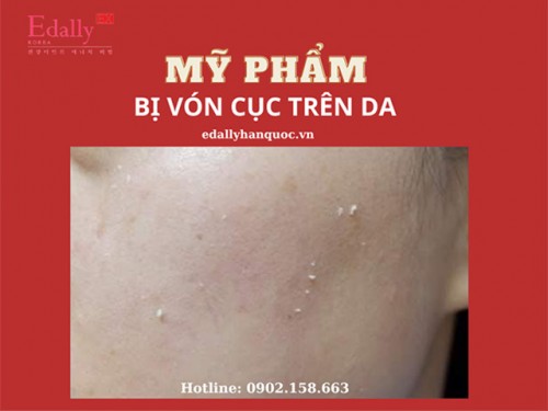 Mỹ Phẩm Bị Vón Cục Trên Da - Tại Sao Lại Thế?