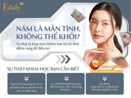 Cách Điều Trị Nám Da