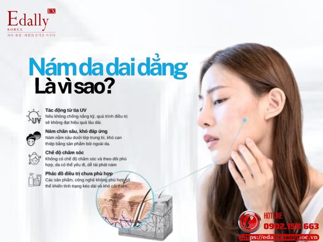 Nám da dai dẳng là do đâu?