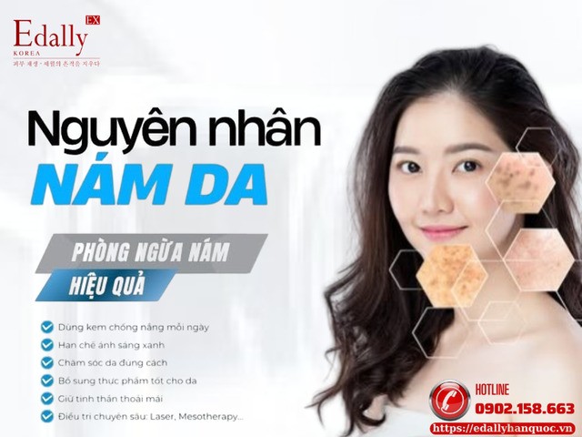 Nguyên nhân và các yếu tố gây nám da