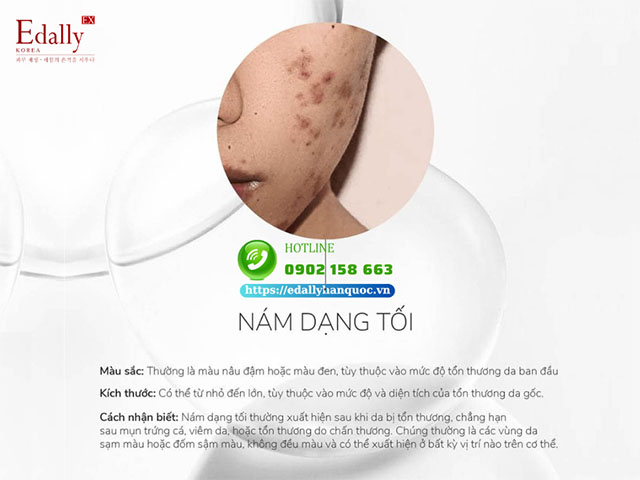 Nám dạng tối là gì?