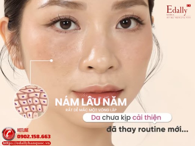 Người bị nám lâu năm dễ mắc phải một vòng lặp là da chưa kịp cải thiện đã thay đổi routine mới
