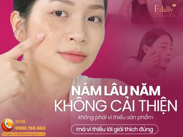 Nám lâu năm không cải thiện không phải vì thiếu sản phẩm mà vì thiếu lời giải thích đúng