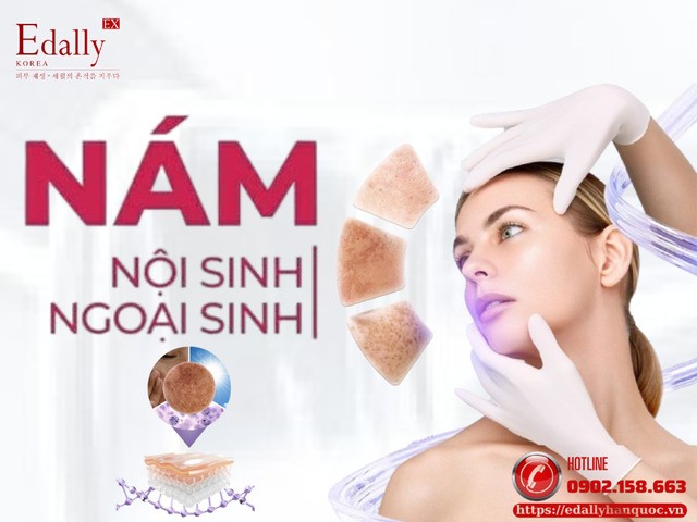 Nám nội sinh và nám ngoại sinh - phân biệt để điều trị đúng Nám nội sinh và nám ngoại sinh - phân biệt để điều trị đúng