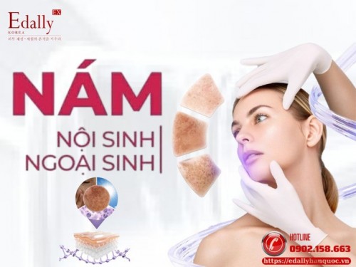 Nám Nội Sinh Và Nám Ngoại Sinh - Phân Biệt Để Trị Đúng