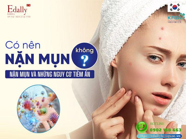 Nặn mụn và những nguy cơ tiềm ẩn khi nặn mụn sai cách