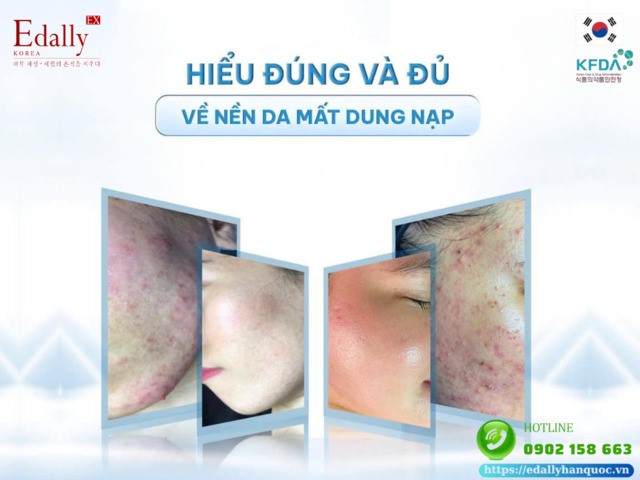 Hiểu rõ về nền da mất dung nạp và cách chăm sóc hiệu quả tại nhà