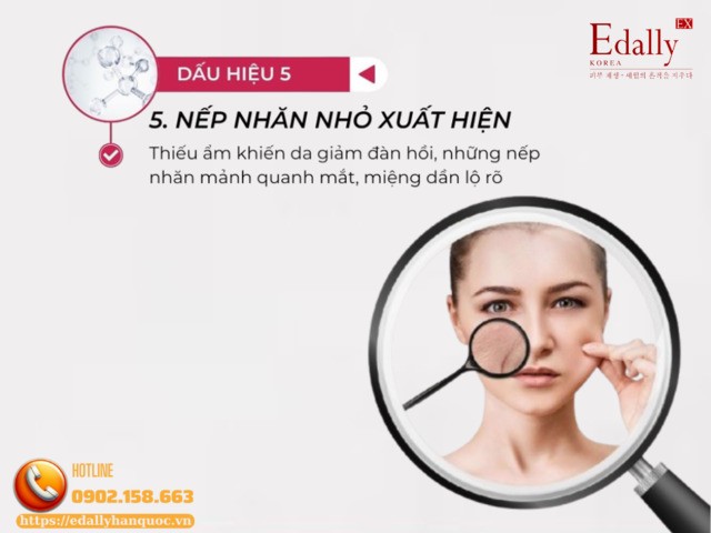 Nếp nhăn nhỏ xuất hiện là dấu hiệu làn da stress vào thời điểm giao mùa Nếp nhăn nhỏ xuất hiện là dấu hiệu làn da stress vào thời điểm giao mùa