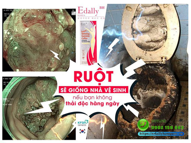 Đường ruột sẽ giống như nhà vệ sinh nếu bạn không thải độc và dọn sạch cặn bẩn hàng ngày