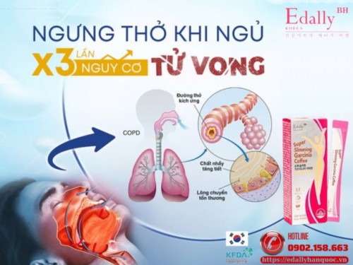 Ngưng Thở Khi Ngủ - Kẻ Giấu Mặt Làm Tim Ta Mệt Mỗi Đêm