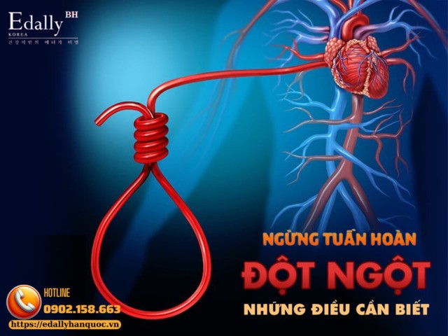 Ngừng Tuần Hoàn Đột Ngột - Những Điều Cần Biết