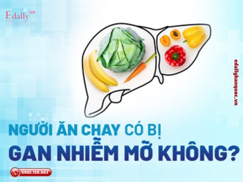 Người Ăn Chay Có Bị Gan Nhiễm Mỡ Không?