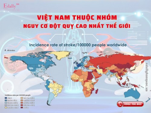 Tại Sao Người Việt Nam Thuộc Nhóm Nguy Cơ Đột Quỵ Cao Nhất Thế Giới?