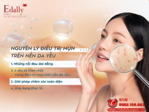 Nguyên Lý Điều Trị Mụn Trên Nền Da Yếu