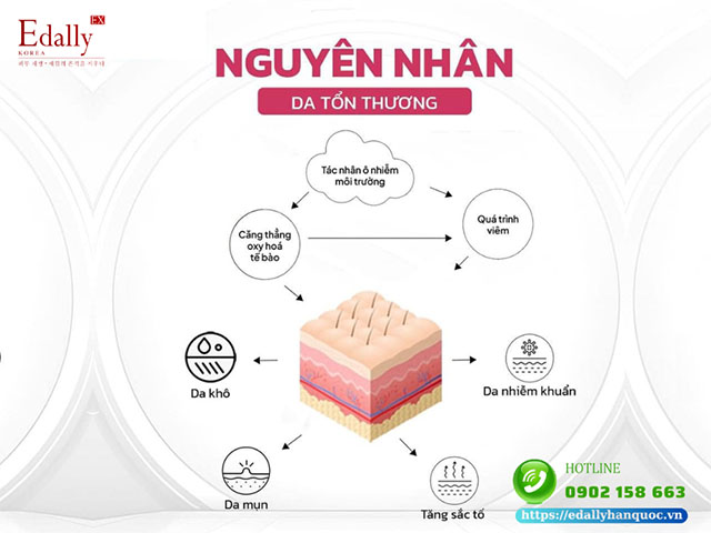 Nguyên nhân khiến da bị tổn thương