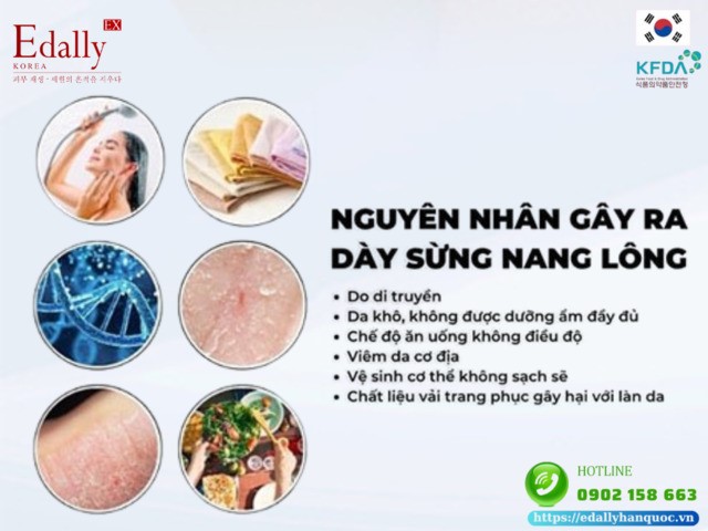 Tại sao da lại bị dày sừng nang lông?