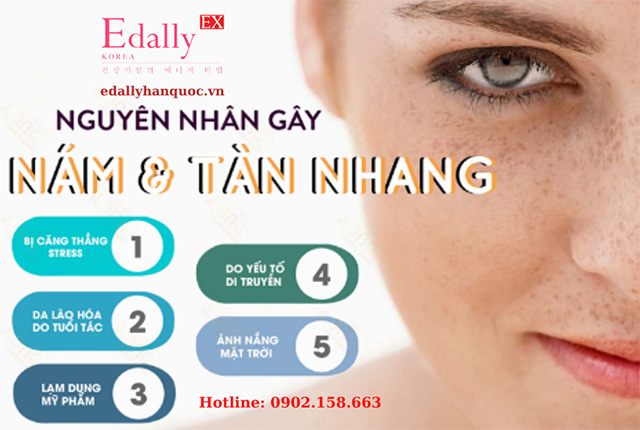 Nguyên nhân gây bệnh nám da và tàn nhang