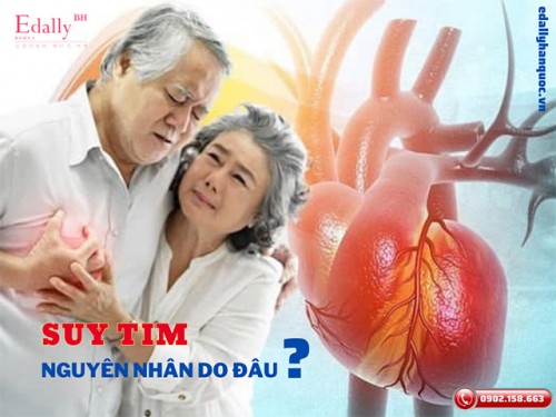 Nguyên Nhân Gây Suy Tim - Điều Không Phải Ai Cũng Biết