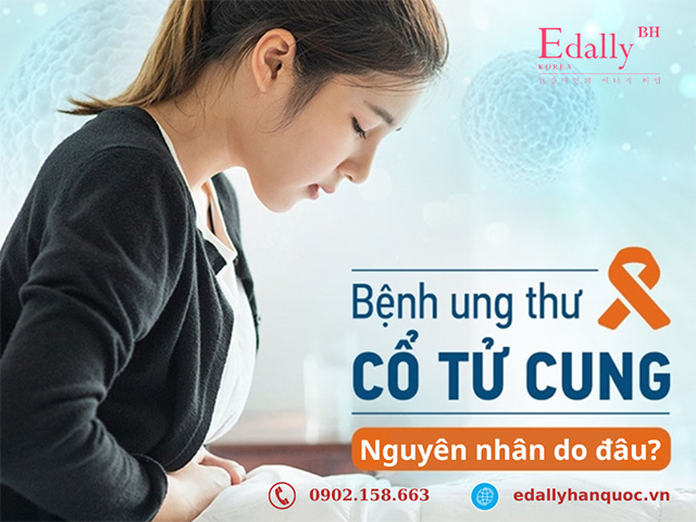 Những nguyên nhân gây bệnh ung thư cổ tử cung ở phụ nữ