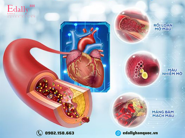 Cảnh Báo Nguyên Nhân Gây Đột Quỵ Hết Sức Nguy Hiểm