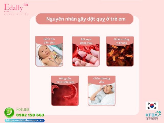 Nguyên nhân gây đột quỵ ở trẻ em là gì?