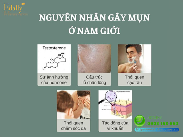 Nguyên nhân khiến mụn hình thành trên làn da nam giới